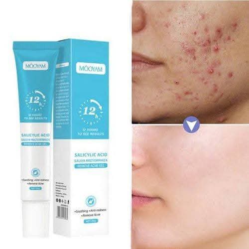 MOOYAM Salicylic Acid Salvia Miltiorrhiza Remove Acne Gel